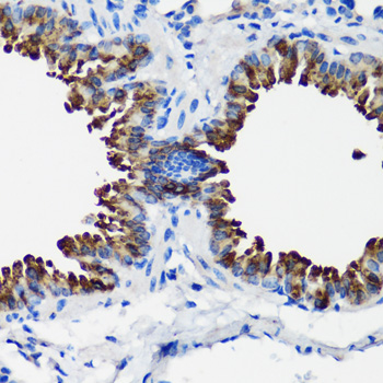 Immunohistochemistry of paraffin-embedded Mouse lung using SCGB1A1 Polyclonal Antibody at dilution of  1:100 (40x lens).