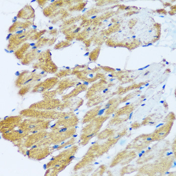 Immunohistochemistry of paraffin-embedded Rat heart using ARHGEF5 Polyclonal Antibody at dilution of  1:100 (40x lens).