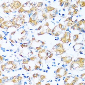 Immunohistochemistry of paraffin-embedded Human stomach using ARHGEF5 Polyclonal Antibody at dilution of  1:100 (40x lens).