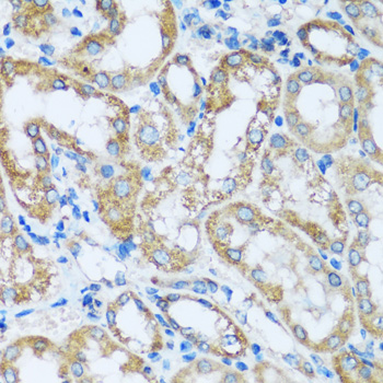 Immunohistochemistry of paraffin-embedded Mouse kidney using ARHGEF5 Polyclonal Antibody at dilution of  1:100 (40x lens).