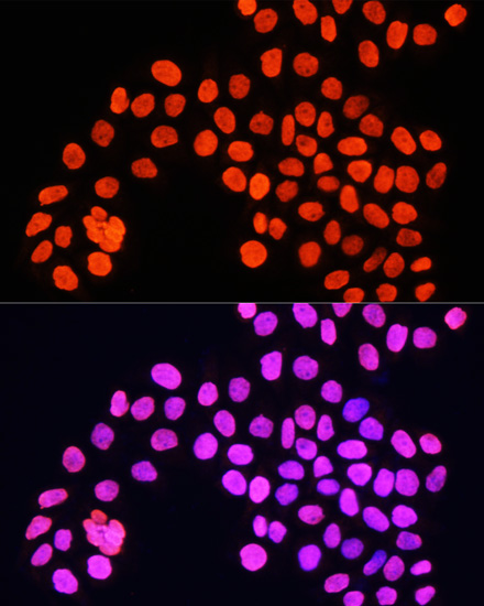 Immunofluorescence analysis of HeLa cells using Histone H4 Polyclonal Antibody at dilution of  1:100. Blue: DAPI for nuclear staining.