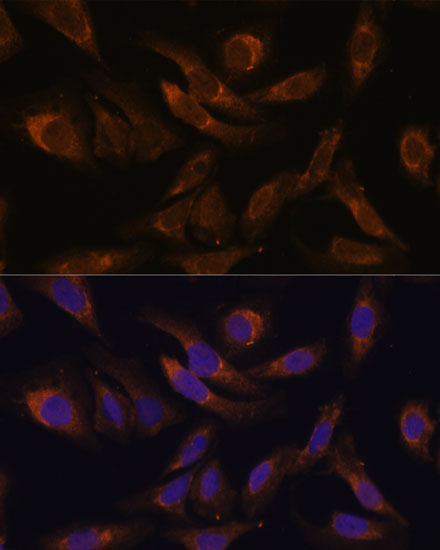 Immunofluorescence analysis of U-2 OS cells using SOCS2 Polyclonal Antibody at dilution of  1:100 (40x lens). Blue: DAPI for nuclear staining.