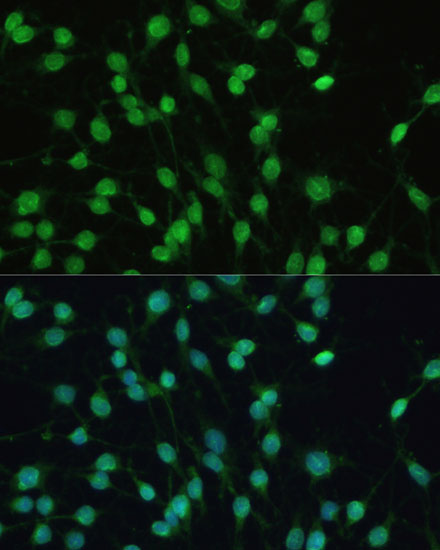 Immunofluorescence analysis of C6 cells using PXR Polyclonal Antibody at dilution of  1:100 (40x lens). Blue: DAPI for nuclear staining.