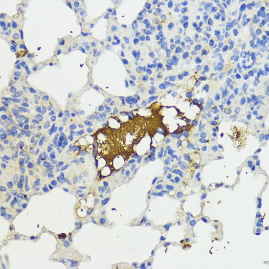 Immunohistochemistry of paraffin-embedded Mouse lung using Complement Factor B Polyclonal Antibody at dilution of  1:200 (40x lens).