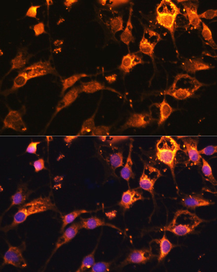 Immunofluorescence analysis of C6 cells using DRP1 Polyclonal Antibody at dilution of  1:100. Blue: DAPI for nuclear staining.