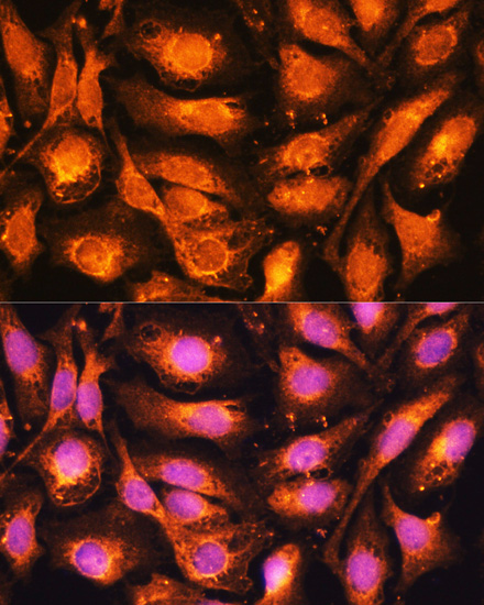 Immunofluorescence analysis of U2OS cells using DRP1 Polyclonal Antibody at dilution of  1:100. Blue: DAPI for nuclear staining.