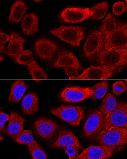 Confocal immunofluorescence analysis of U-2 OS cells using DRP1 Polyclonal Antibody at dilution of  1:200. Blue: DAPI for nuclear staining.