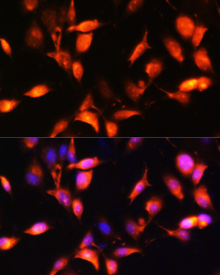 Immunofluorescence analysis of NIH-3T3 cells using ARL4A Polyclonal Antibody at dilution of  1:100. Blue: DAPI for nuclear staining.