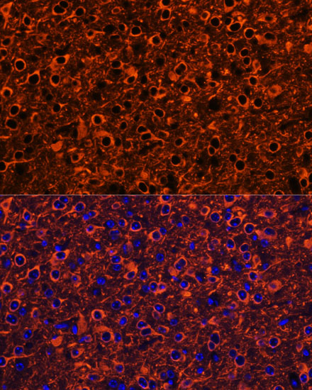 Immunofluorescence analysis of Mouse brain using TUBB3 Polyclonal Antibody at dilution of  1:100. Blue: DAPI for nuclear staining.