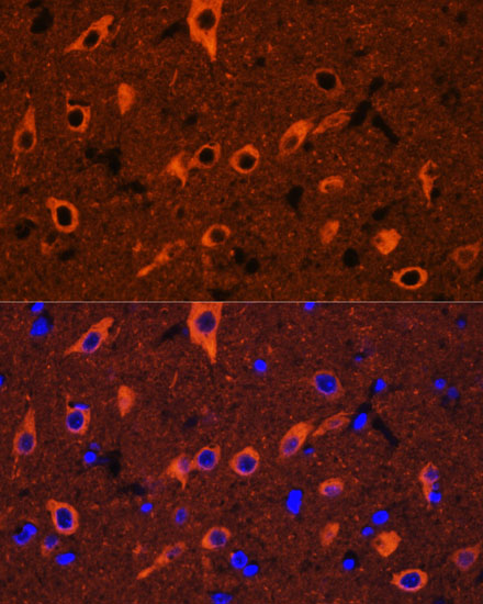 Immunofluorescence analysis of Rat brain using TUBB3 Polyclonal Antibody at dilution of  1:100. Blue: DAPI for nuclear staining.