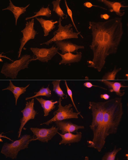 Immunofluorescence analysis of U-251MG cells using TUBB3 Polyclonal Antibody at dilution of  1:100. Blue: DAPI for nuclear staining.