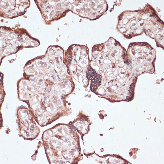 Immunohistochemistry of paraffin-embedded Human placenta using YAP1 Polyclonal Antibody at dilution of  1:100 (40x lens).