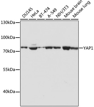 Western blot analysis of extracts of various cell lines using YAP1 Polyclonal Antibody at dilution of 1:1000.