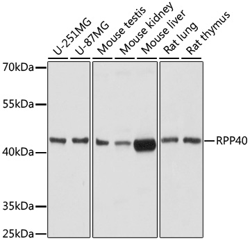 Western blot analysis of extracts of various cell lines using RPP40 Polyclonal Antibody at dilution of 1:1000.