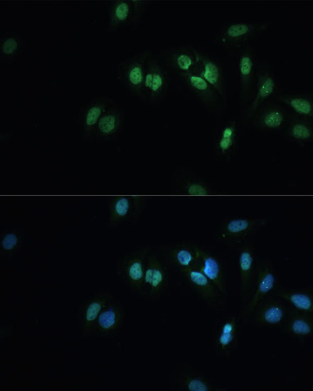 Immunofluorescence analysis of U-2 OS cells using TARDBP Polyclonal Antibody at dilution of  1:100 (40x lens). Blue: DAPI for nuclear staining.