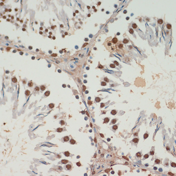 Immunohistochemistry of paraffin-embedded Rat testis using TARDBP Polyclonal Antibody at dilution of  1:200 (40x lens).