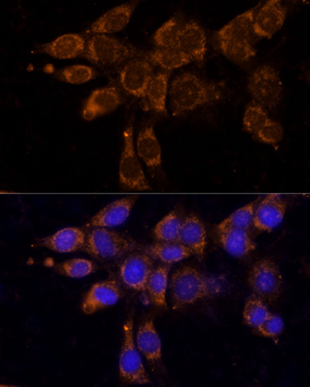 Immunofluorescence analysis of NIH/3T3 cells using CYP11A1 Polyclonal Antibody at dilution of  1:100. Blue: DAPI for nuclear staining.