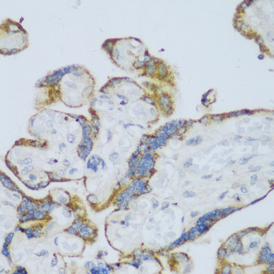 Immunohistochemistry of paraffin-embedded Human placenta using CYP11A1 Polyclonal Antibody at dilution of  1:150 (40x lens).