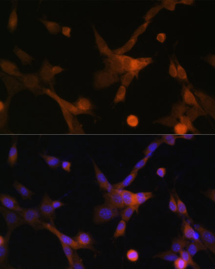 Immunofluorescence analysis of NIH-3T3 cells using BBC3 Polyclonal Antibody at dilution of  1:100 (40x lens). Blue: DAPI for nuclear staining.