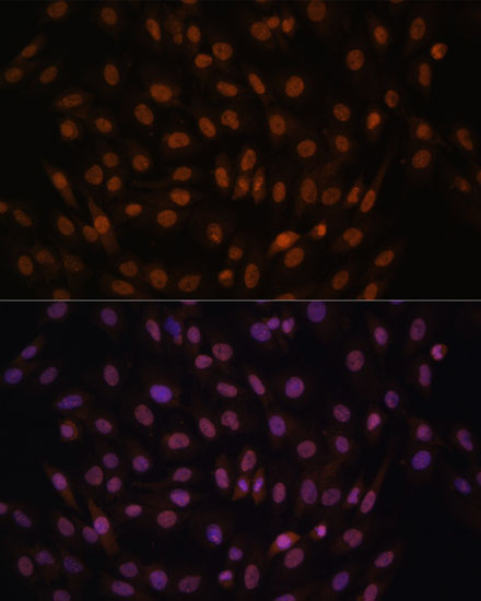 Immunofluorescence analysis of C6 cells using FCF1 Polyclonal Antibody at dilution of  1:100. Blue: DAPI for nuclear staining.