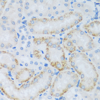 Immunohistochemistry of paraffin-embedded Mouse kidney using ASB4 Polyclonal Antibody at dilution of  1:100 (40x lens).