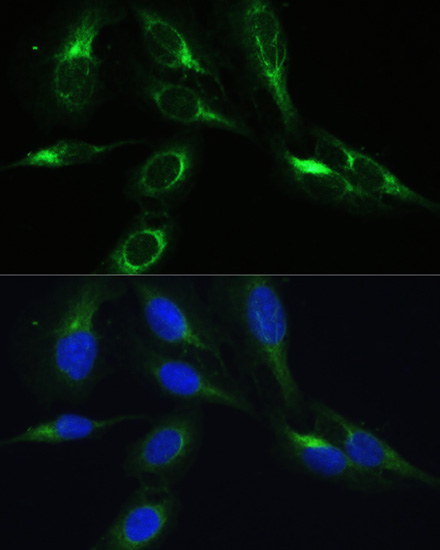 Immunofluorescence analysis of U-2 OS cells using BRK1 Polyclonal Antibody at dilution of  1:100. Blue: DAPI for nuclear staining.