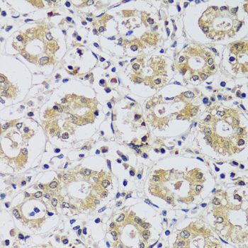 Immunohistochemistry of paraffin-embedded Human stomach using C12orf10 Polyclonal Antibody at dilution of  1:100 (40x lens).