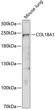 Western blot analysis of extracts of Mouse lung using COL18A1 Polyclonal Antibody at dilution of 1:1000.
