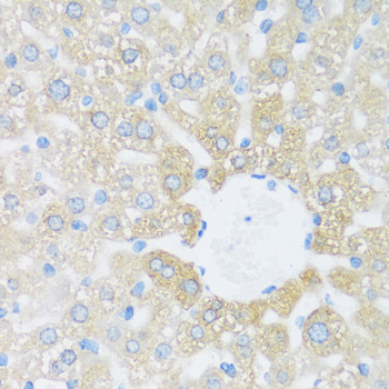 Immunohistochemistry of paraffin-embedded Rat liver using BRSK1 Polyclonal Antibody at dilution of  1:100 (40x lens).