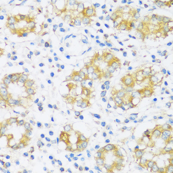 Immunohistochemistry of paraffin-embedded Human stomach using BRSK1 Polyclonal Antibody at dilution of  1:100 (40x lens).