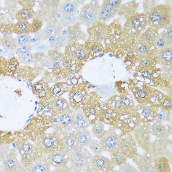 Immunohistochemistry of paraffin-embedded Mouse liver using BRSK1 Polyclonal Antibody at dilution of  1:100 (40x lens).