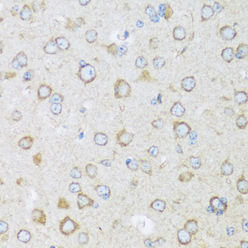 Immunohistochemistry of paraffin-embedded Mouse brain using BRSK1 Polyclonal Antibody at dilution of  1:100 (40x lens).