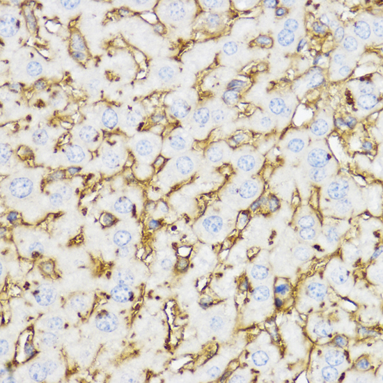 Immunohistochemistry of paraffin-embedded Mouse liver using YKL-40 / CHI3L1 Polyclonal Antibody at dilution of  1:100 (40x lens).