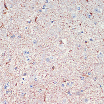 Immunohistochemistry of paraffin-embedded Mouse spinal cord using LRRK2 Polyclonal Antibody at dilution of  1:200 (40x lens).