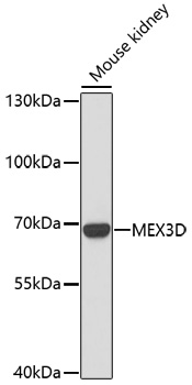 Western blot analysis of extracts of Mouse kidney using MEX3D Polyclonal Antibody at dilution of 1:1000.