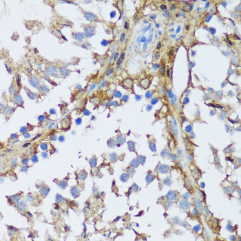 Immunohistochemistry of paraffin-embedded Rat testis using MAPK1/MAPK3 Polyclonal Antibody at dilution of  1:200 (40x lens).