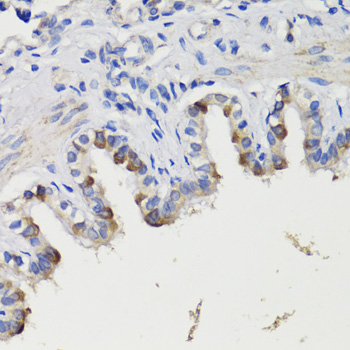 Immunohistochemistry of paraffin-embedded Rat bronchus using DEPDC6 Polyclonal Antibody at dilution of  1:200 (40x lens).