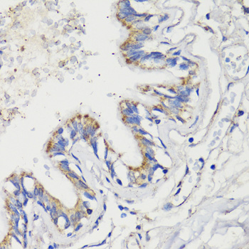 Immunohistochemistry of paraffin-embedded Human lung using DEPDC6 Polyclonal Antibody at dilution of  1:200 (40x lens).