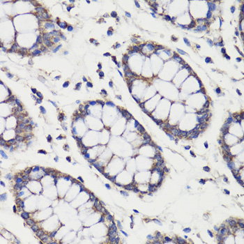 Immunohistochemistry of paraffin-embedded Human colon using DEPDC6 Polyclonal Antibody at dilution of  1:200 (40x lens).