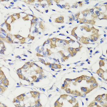 Immunohistochemistry of paraffin-embedded Human stomach using DEPDC6 Polyclonal Antibody at dilution of  1:200 (40x lens).