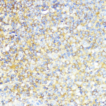 Immunohistochemistry of paraffin-embedded Human tonsil using MLKL Polyclonal Antibody at dilution of  1:200 (40x lens).