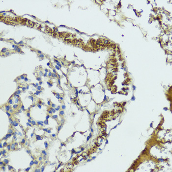 Immunohistochemistry of paraffin-embedded Mouse lung using MLKL Polyclonal Antibody at dilution of  1:200 (40x lens).