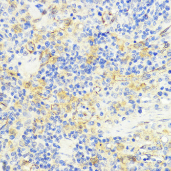 Immunohistochemistry of paraffin-embedded Rat spleen using MLKL Polyclonal Antibody at dilution of  1:200 (40x lens).