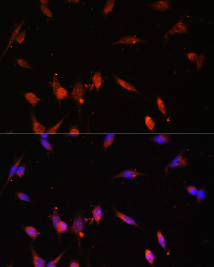 Immunofluorescence analysis of NIH-3T3 cells using PIK3R3 Polyclonal Antibody at dilution of  1:100. Blue: DAPI for nuclear staining.