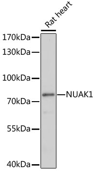 Western blot analysis of extracts of Rat heart using NUAK1 Polyclonal Antibody at dilution of 1:1000.