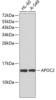 Western blot analysis of extracts of various cell lines using APOC2 Polyclonal Antibody.