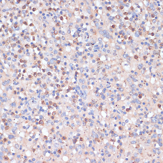 Immunohistochemistry of paraffin-embedded Human spleen using CD82 Polyclonal Antibody at dilution of  1:100 (40x lens).