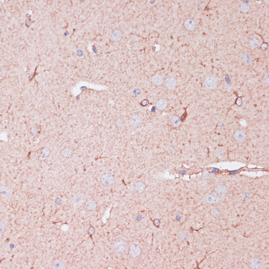 Immunohistochemistry of paraffin-embedded Mouse brain using CD82 Polyclonal Antibody at dilution of  1:100 (40x lens).