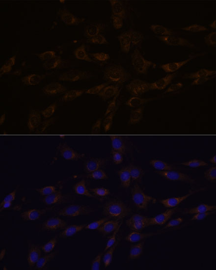 Immunofluorescence analysis of C6 cells using RGS4 Polyclonal Antibody at dilution of  1:100. Blue: DAPI for nuclear staining.