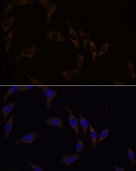 Immunofluorescence analysis of L929 cells using RGS4 Polyclonal Antibody at dilution of  1:100. Blue: DAPI for nuclear staining.
